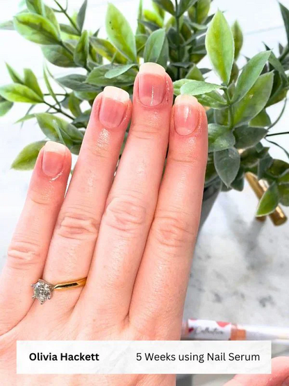 Nordic GrowLab™ – Nail Growth Serum