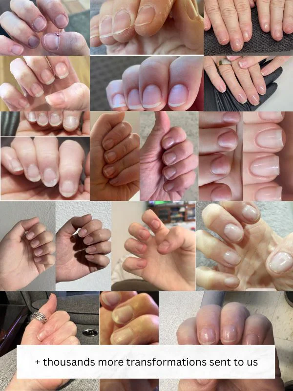 Nordic GrowLab™ – Nail Growth Serum