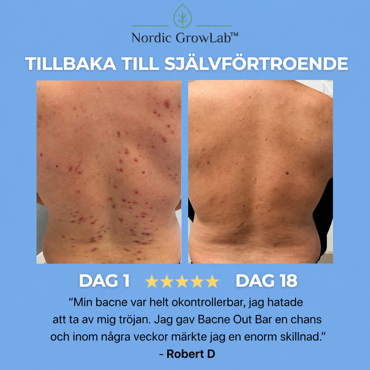 Nordic Growlab™ Bacne Out Bar