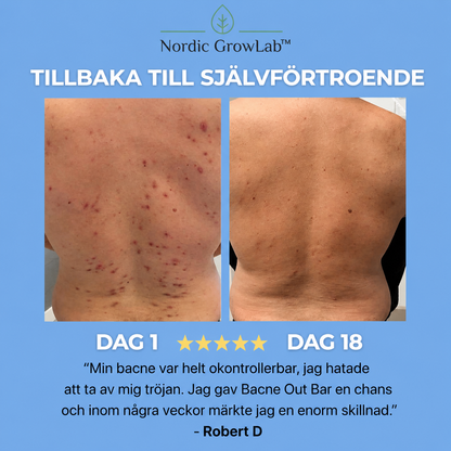 Nordic Growlab™ Bacne Out Bar