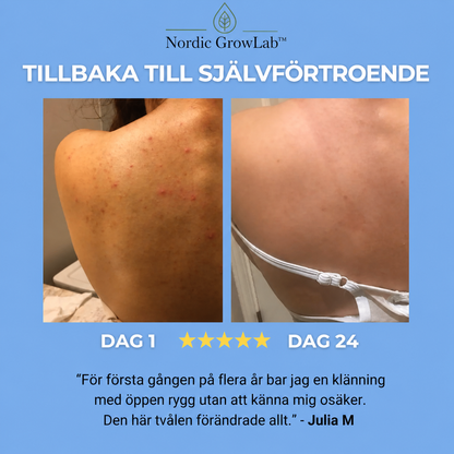Nordic Growlab™ Bacne Out Bar
