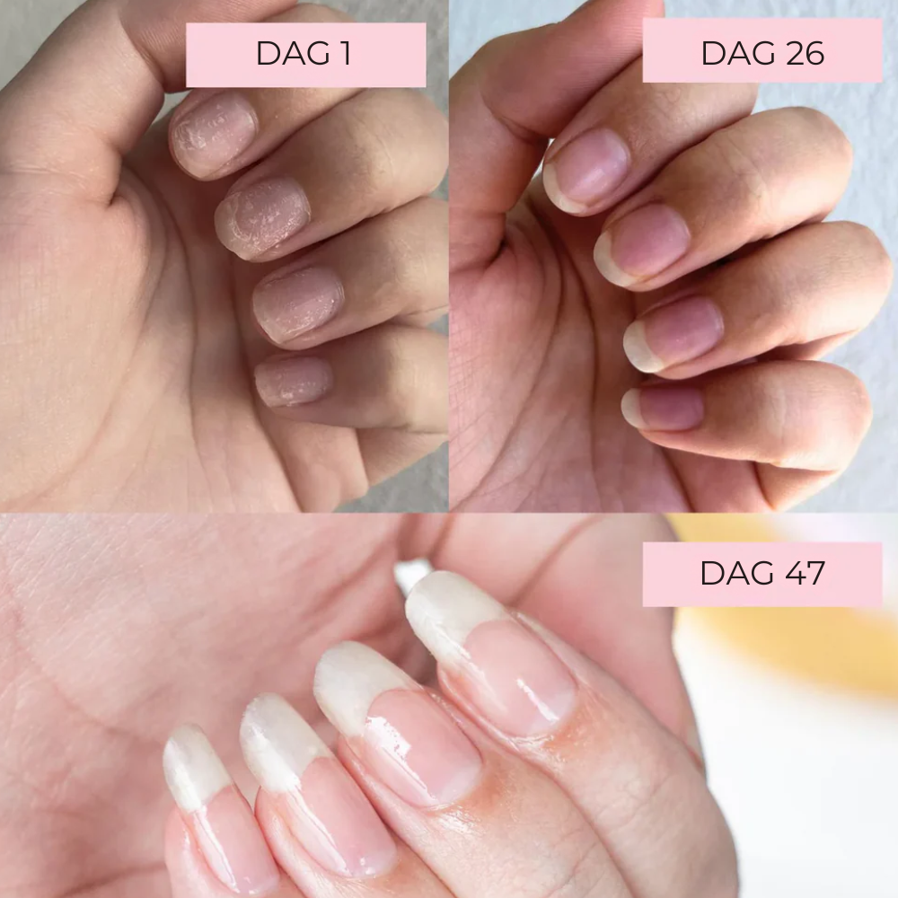 Nordic GrowLab™ – Nail Growth Serum