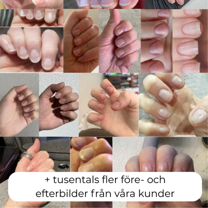 Nordic GrowLab™ – Nail Growth Serum