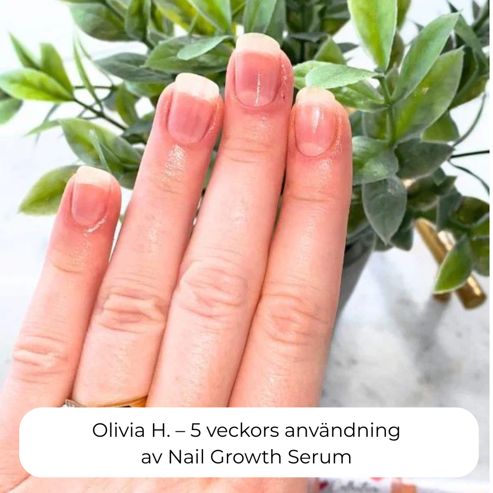 Nordic GrowLab™ – Nail Growth Serum