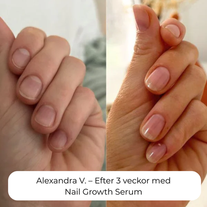 Nordic GrowLab™ – Nail Growth Serum