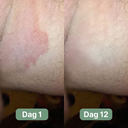 Nordic SkinBalance™ - Djuprengörande kroppsbar för svettutsatta hudområden