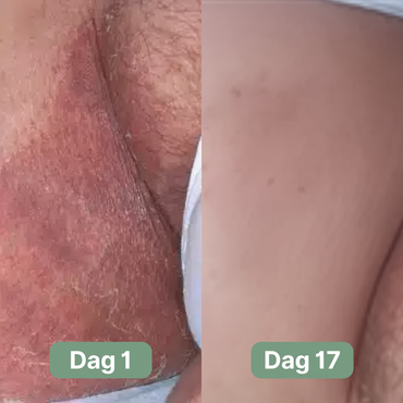 Nordic SkinBalance™ - Djuprengörande kroppsbar för svettutsatta hudområden