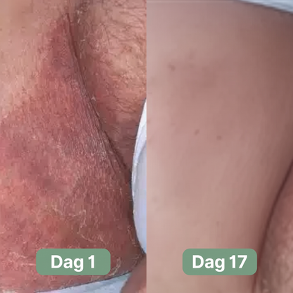 Nordic SkinBalance™ - Djuprengörande kroppsbar för svettutsatta hudområden